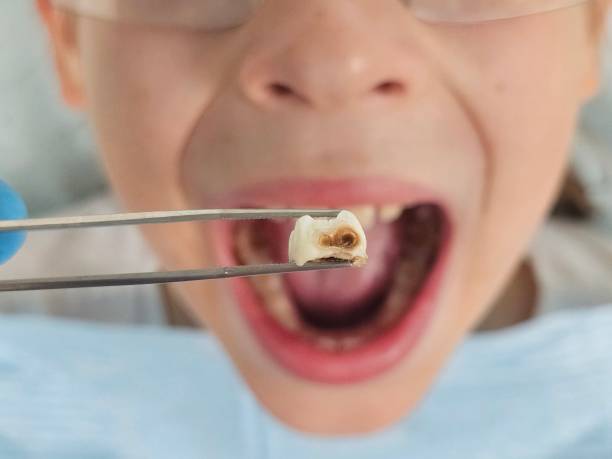 Best Same-Day Emergency Dentist in Cullowhee, NC